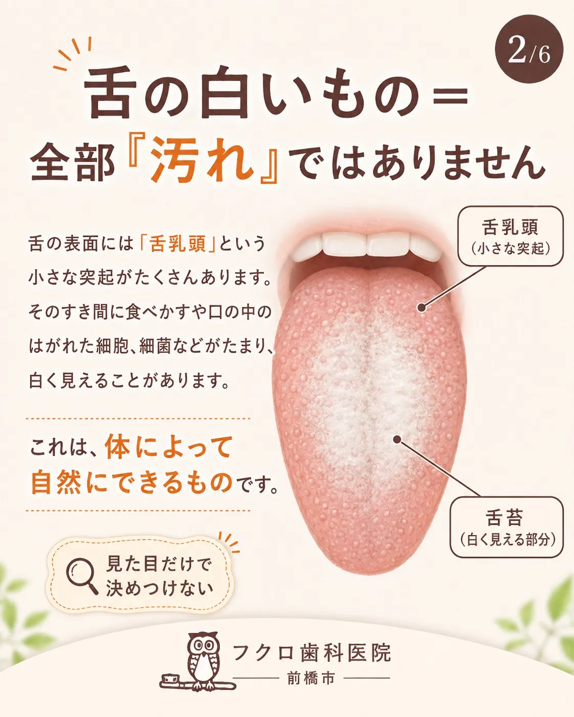「舌が白い=全部汚れだから、しっかり落とした方がいい」
