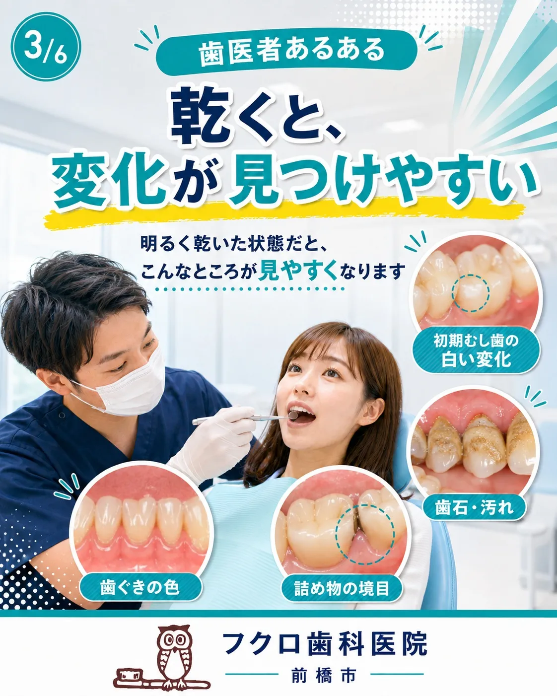 歯医者さんで、ときどき歯に「シューッ」と風をかけられることが...