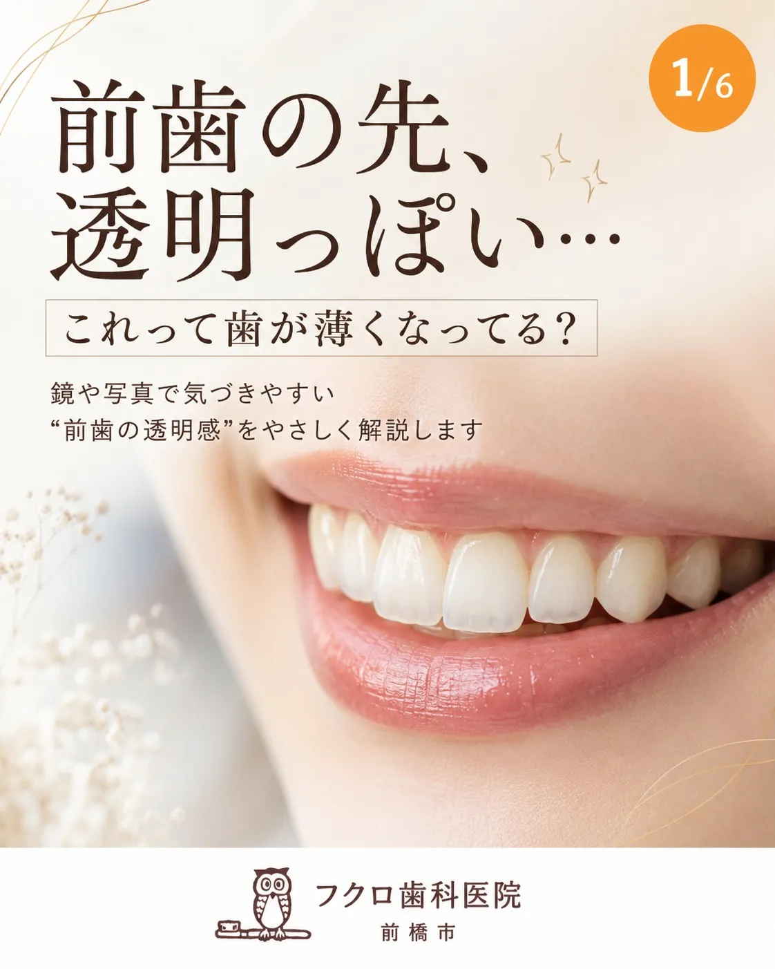 「前歯の先だけ、ちょっと透明っぽい…」