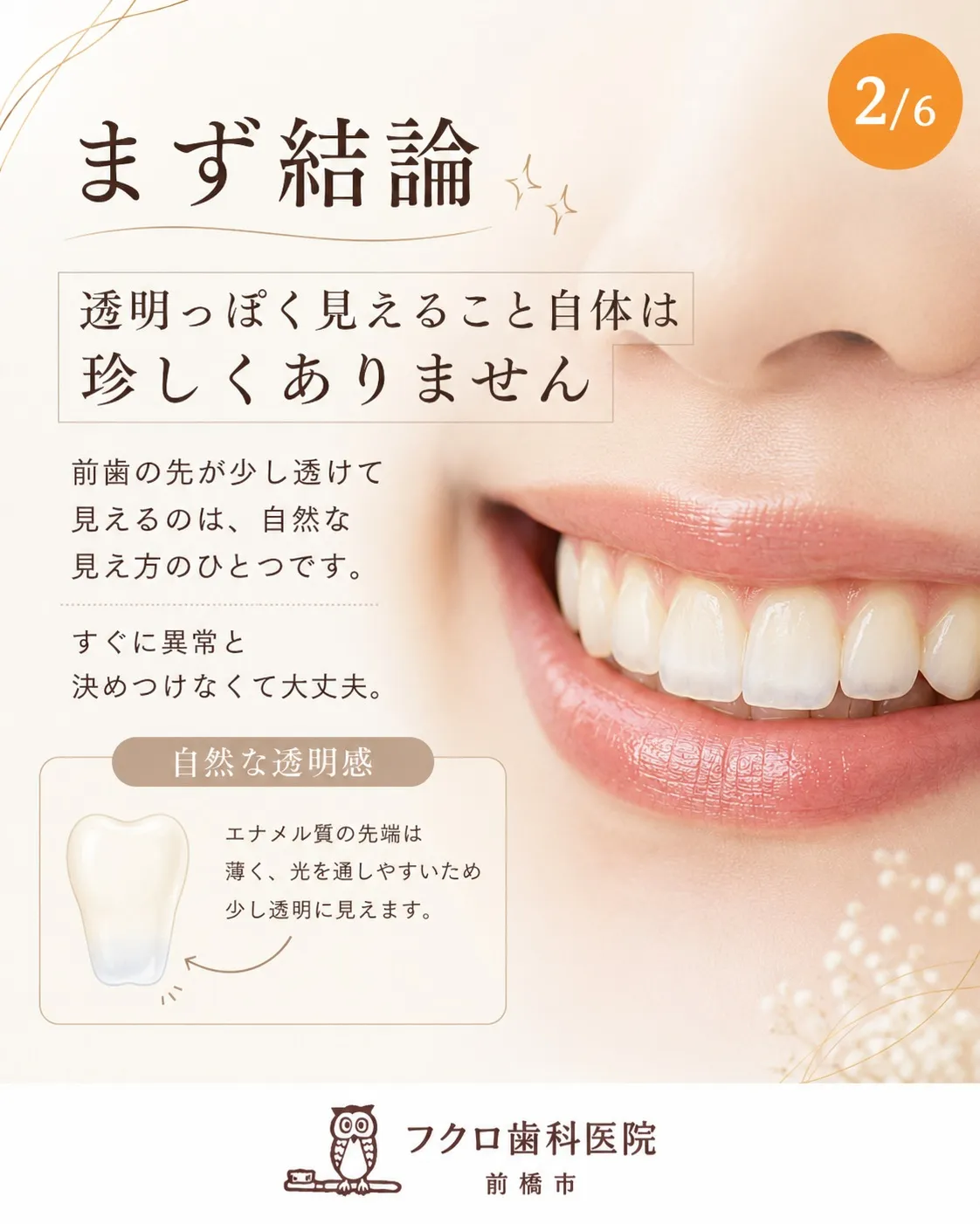 「前歯の先だけ、ちょっと透明っぽい…」
