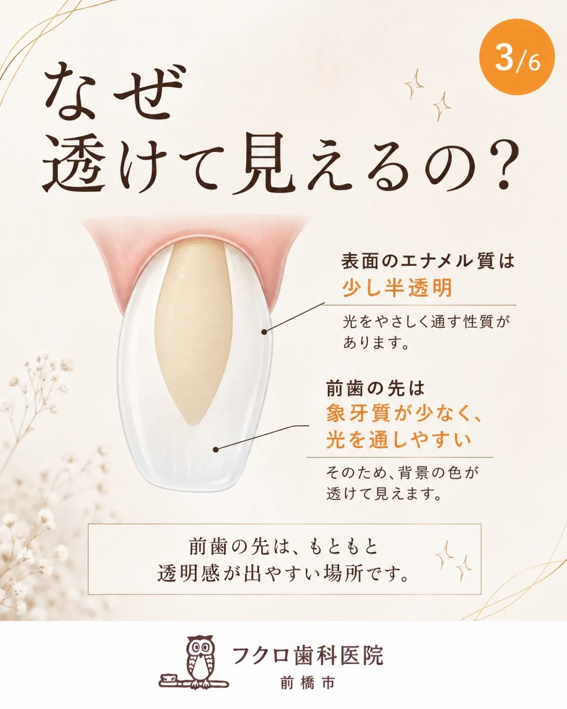 「前歯の先だけ、ちょっと透明っぽい…」
