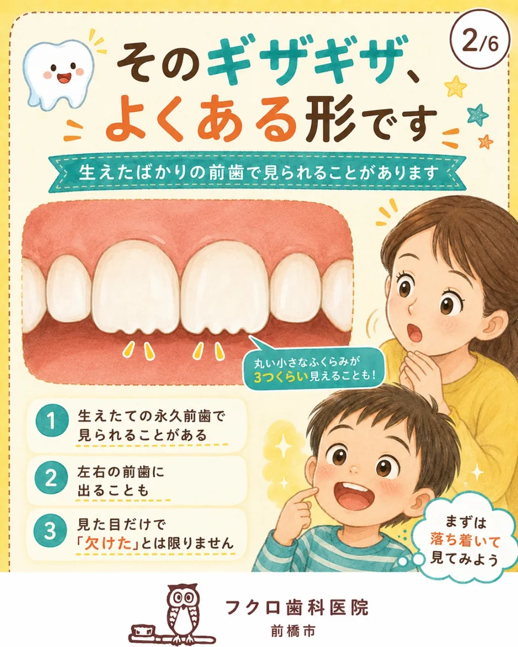 子どもの永久歯が生えてきたと思ったら、前歯の先がギザギザ。