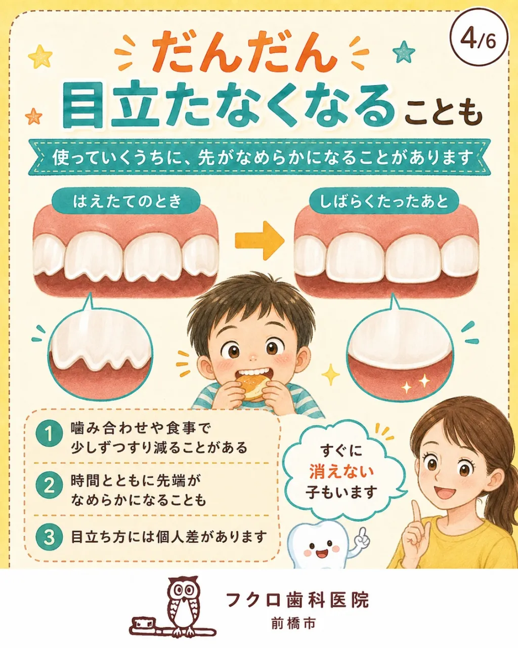 子どもの永久歯が生えてきたと思ったら、前歯の先がギザギザ。