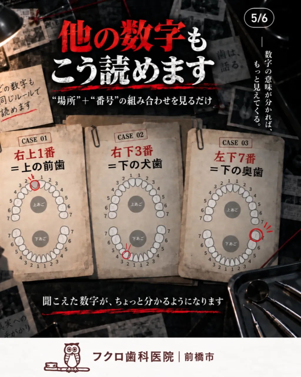 歯医者で聞こえてくる、
