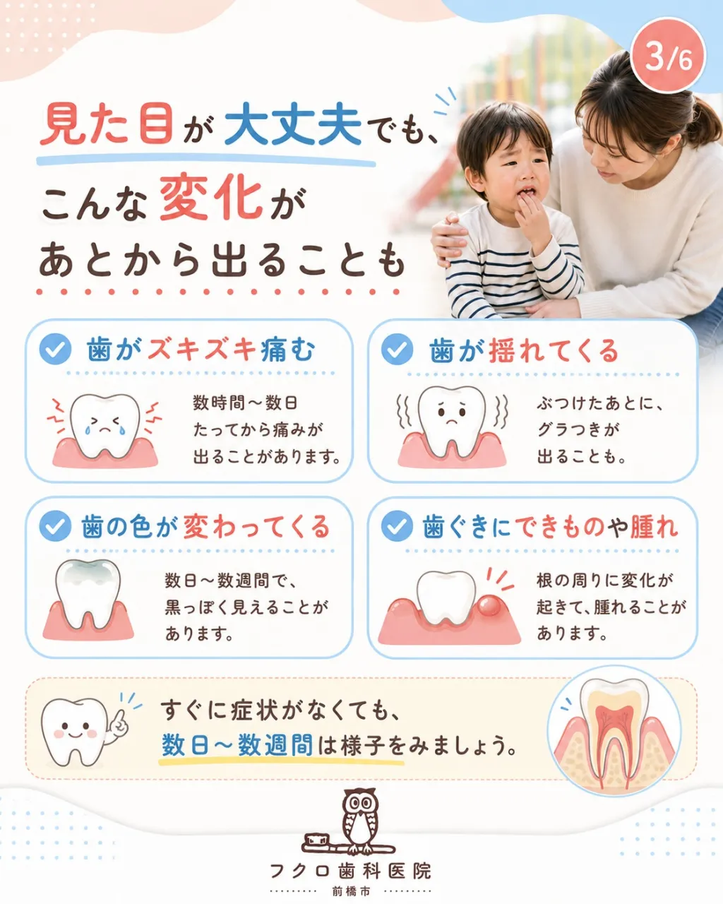 「転んで前歯をぶつけたけど、欠けてないから大丈夫かな?」