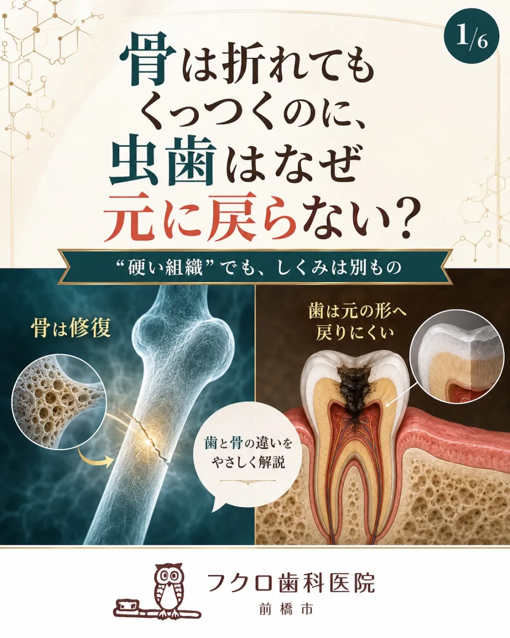 「骨は折れても治るのに、虫歯はなぜ元に戻らないの？」