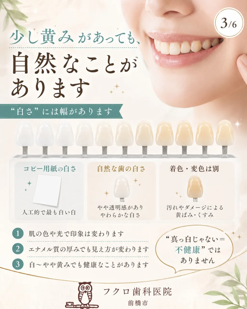 「健康な歯＝真っ白」だと思っていませんか？