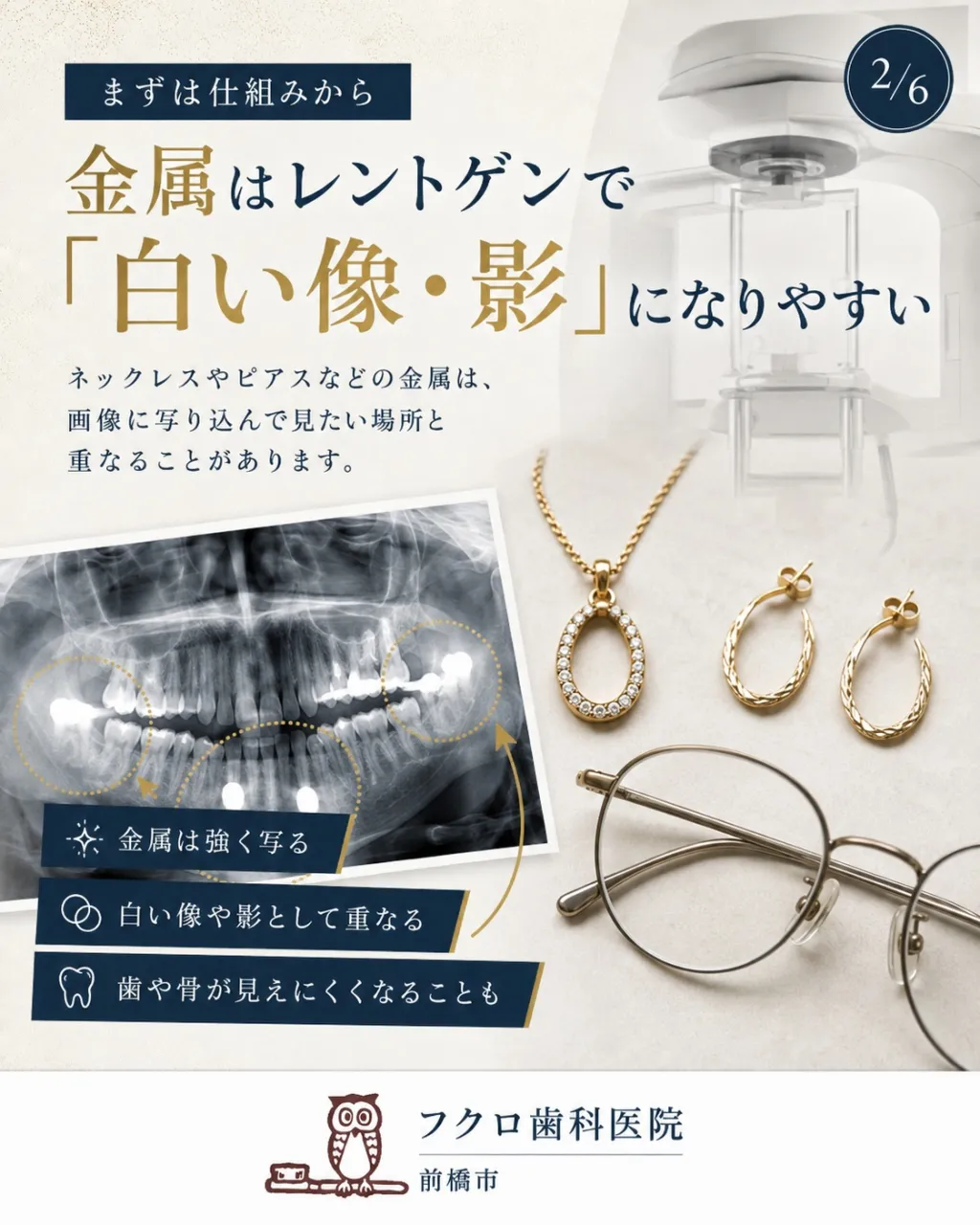 「歯のレントゲンなのに、ネックレスやピアスまで外すの?」
