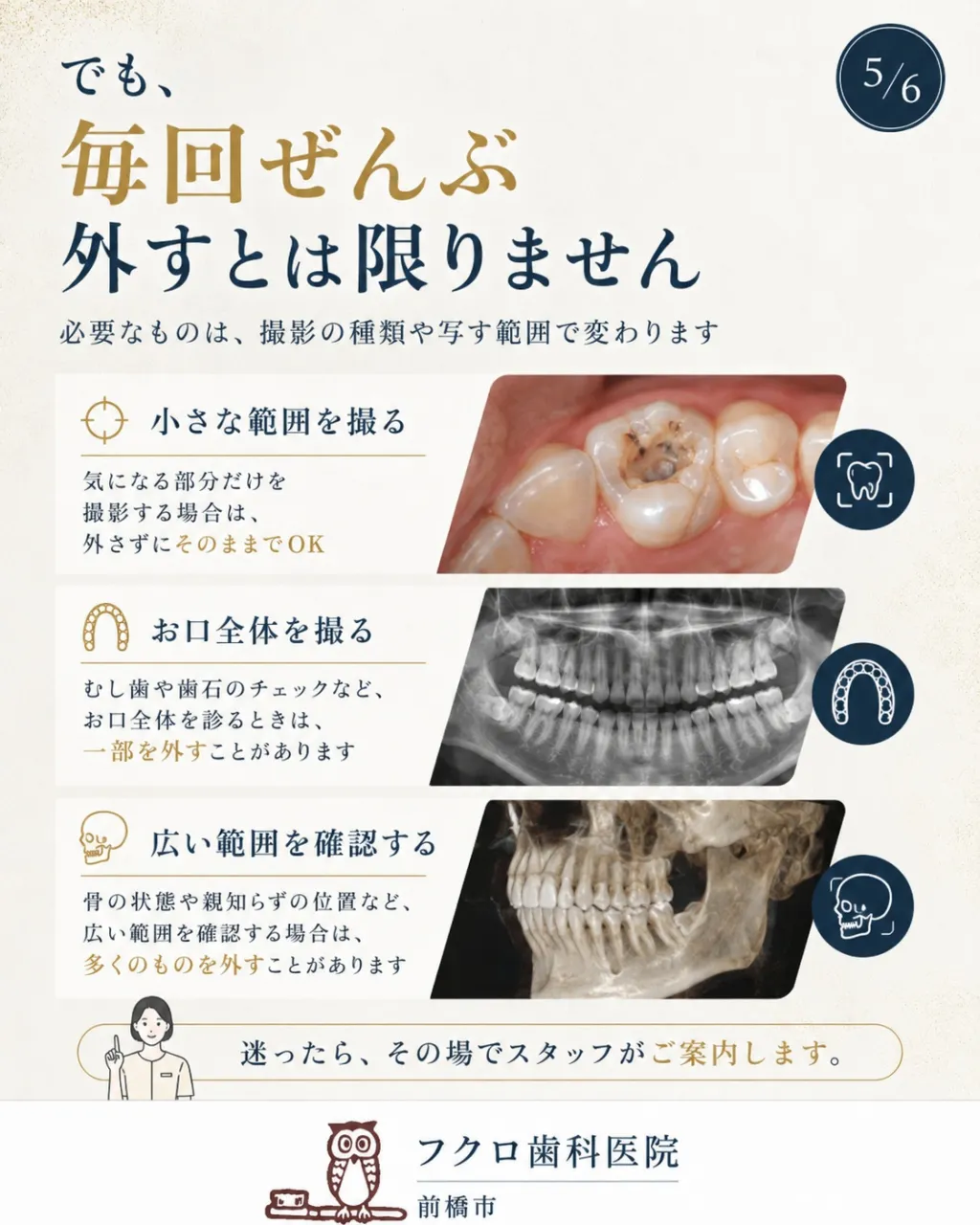 「歯のレントゲンなのに、ネックレスやピアスまで外すの?」