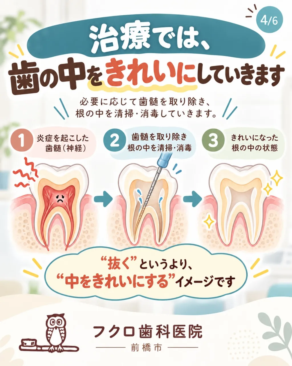 「歯の神経を取ります」と言われると、