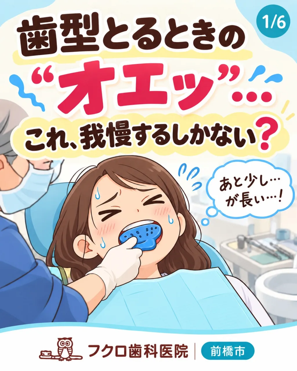 「歯型をとりますね」と言われると、