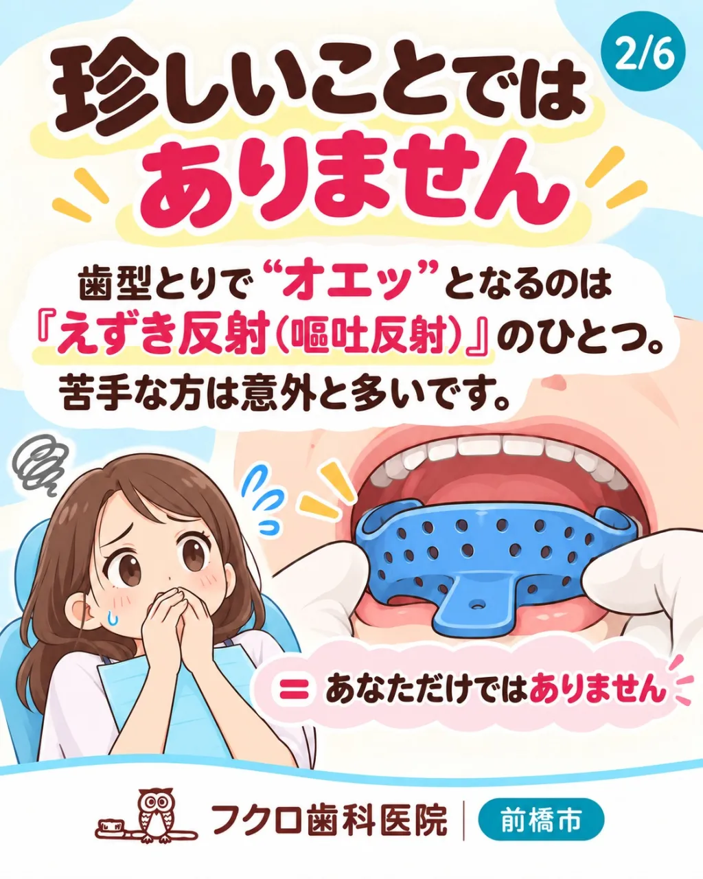 「歯型をとりますね」と言われると、
