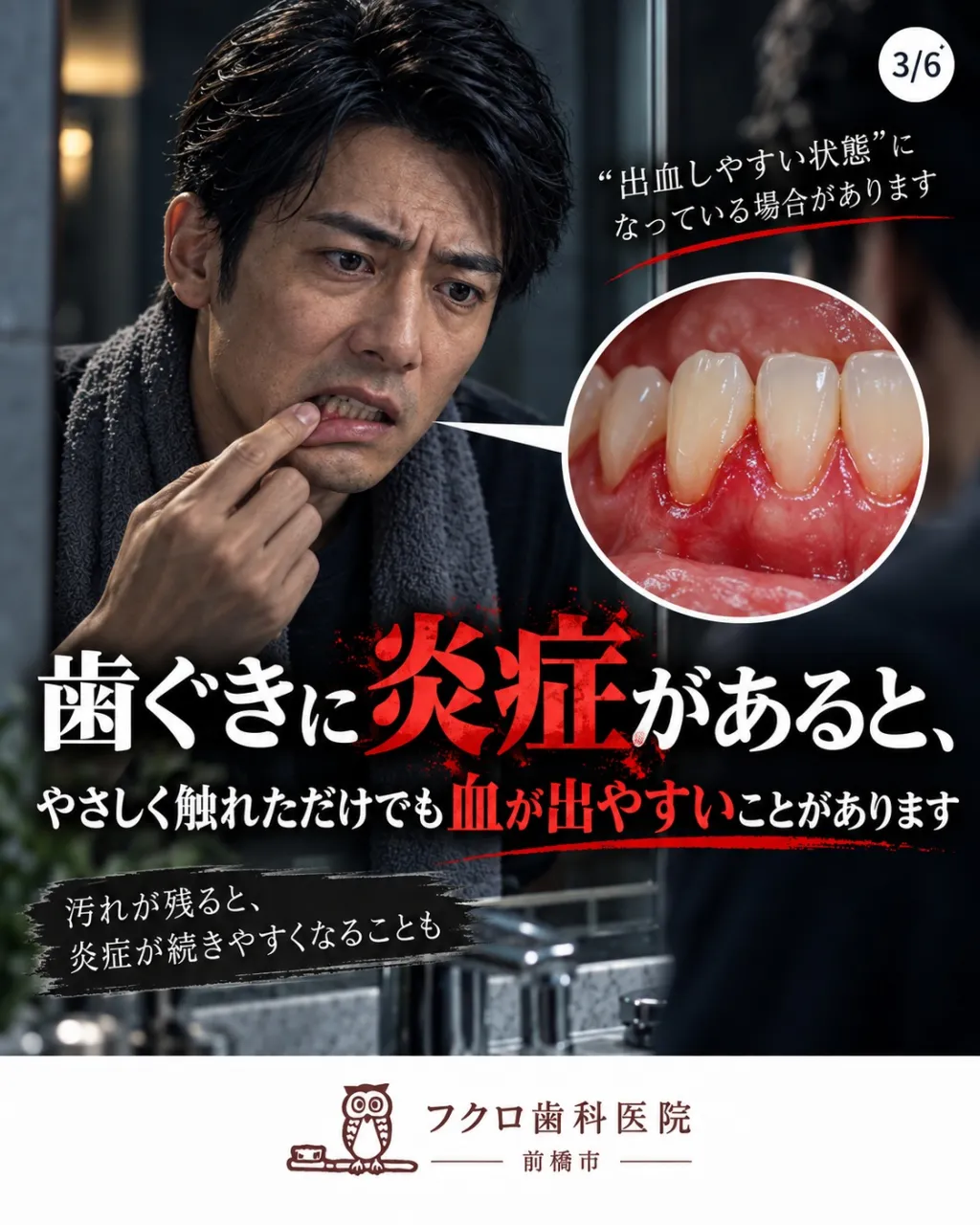 歯みがき中、歯ブラシに血がつくと、