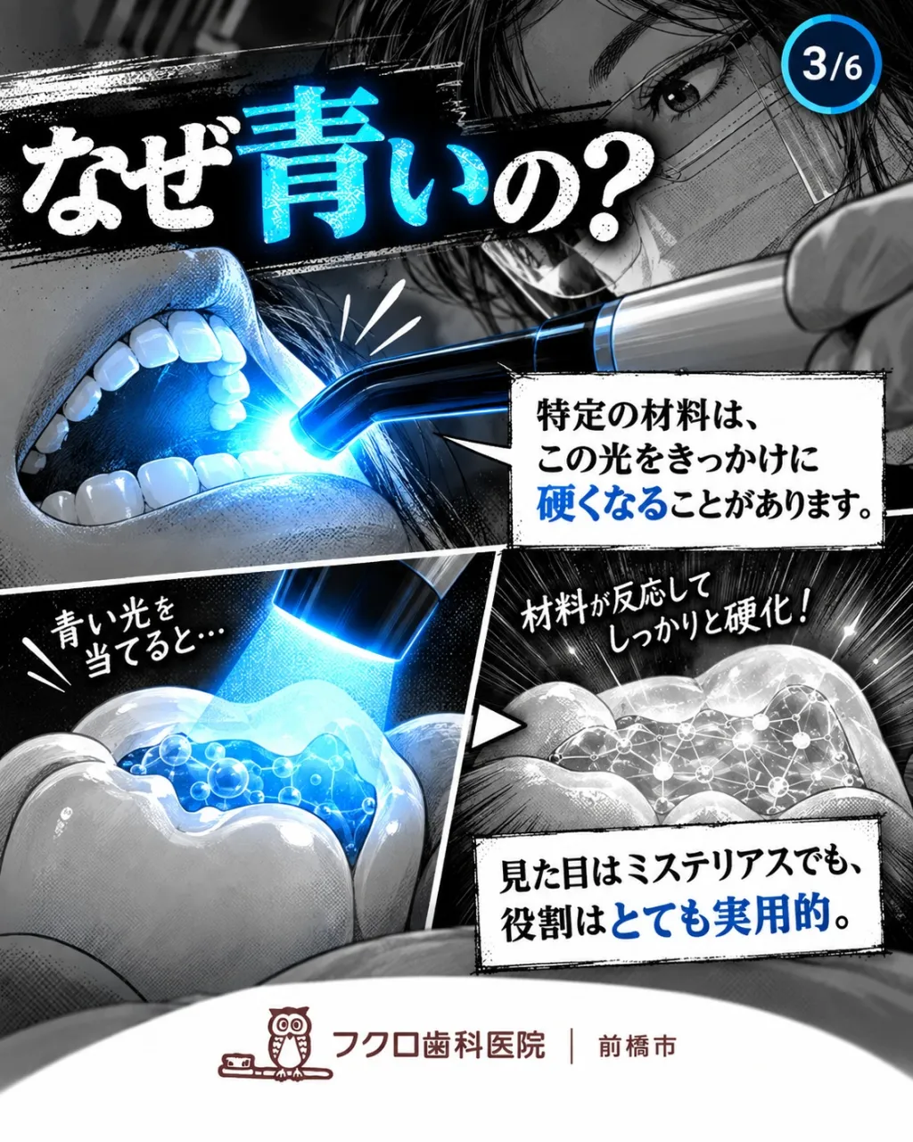 歯医者で治療中、突然「ピカッ」と青い光を当てられて、