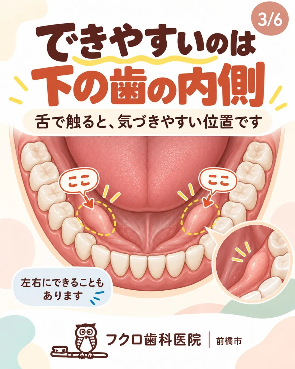 舌で下の歯の内側を触ったとき、