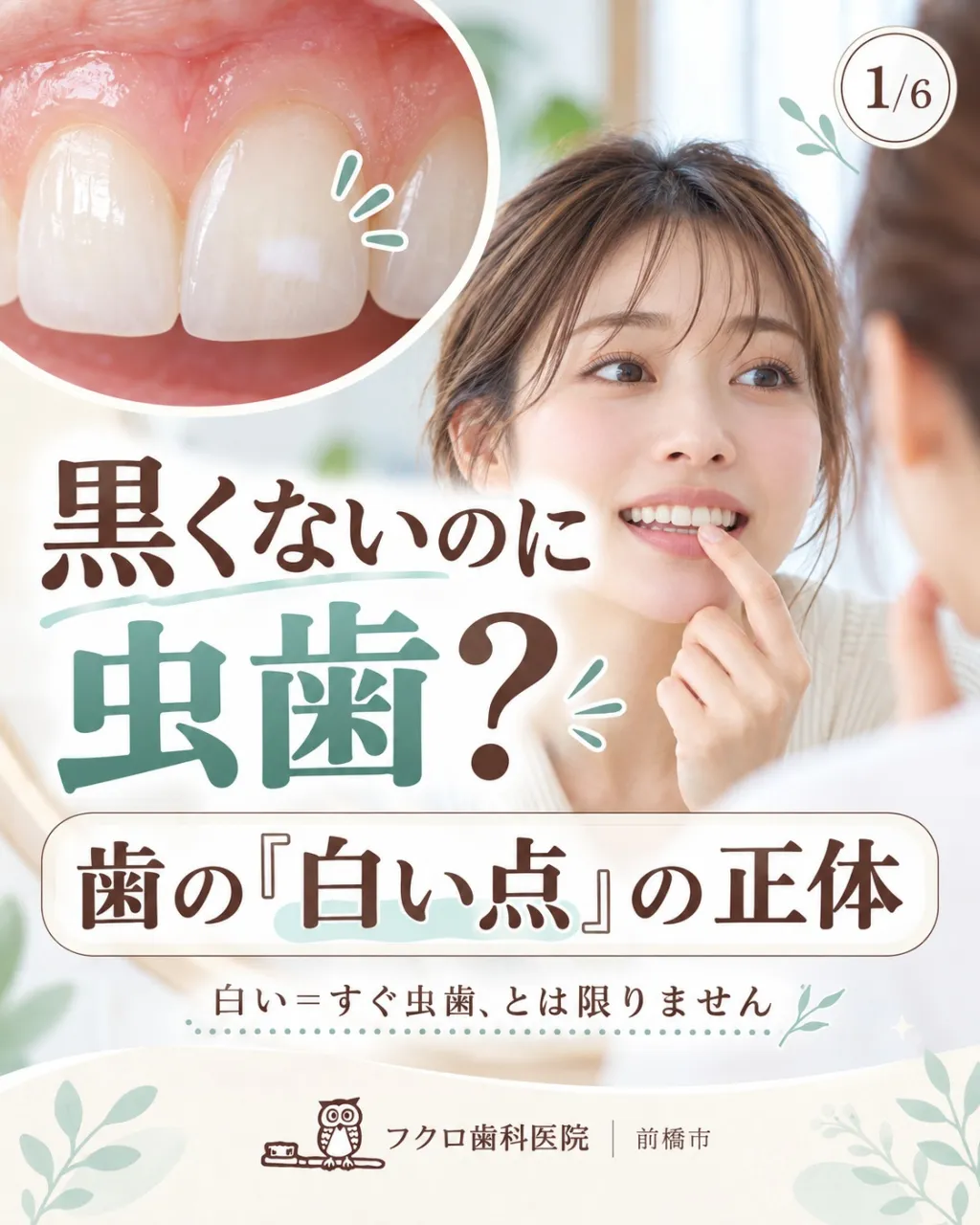鏡やスマホで前歯を見たとき、