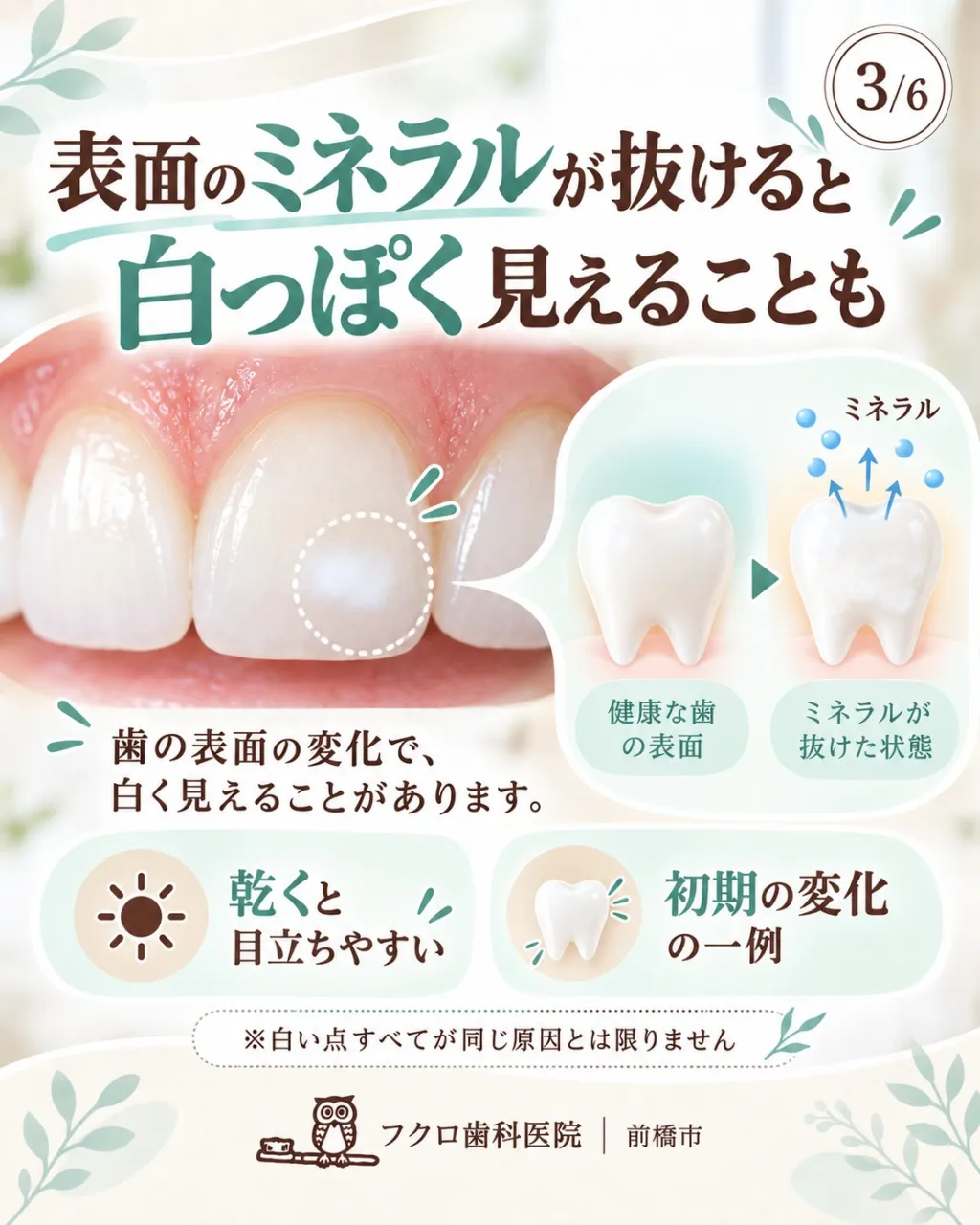 鏡やスマホで前歯を見たとき、