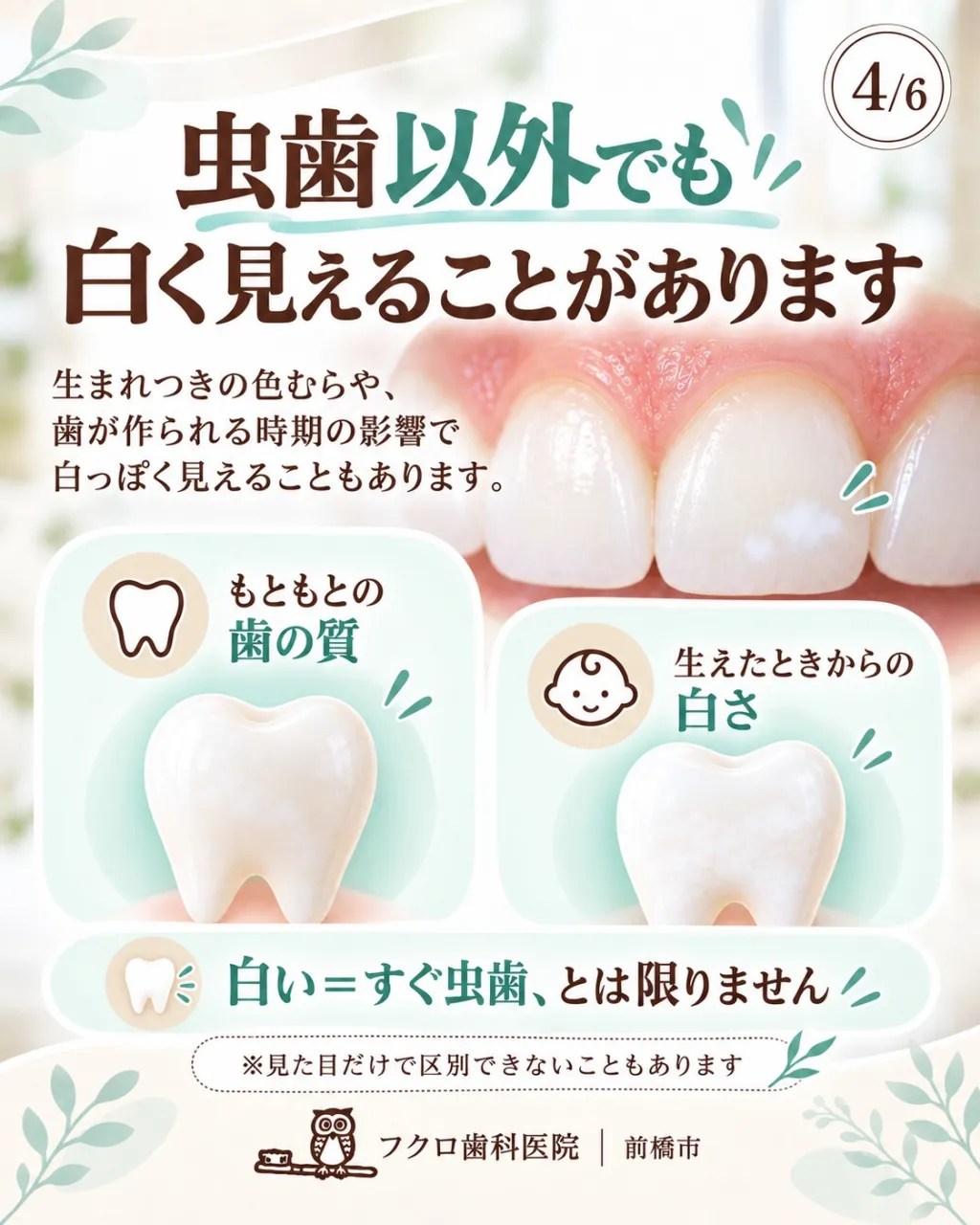 鏡やスマホで前歯を見たとき、