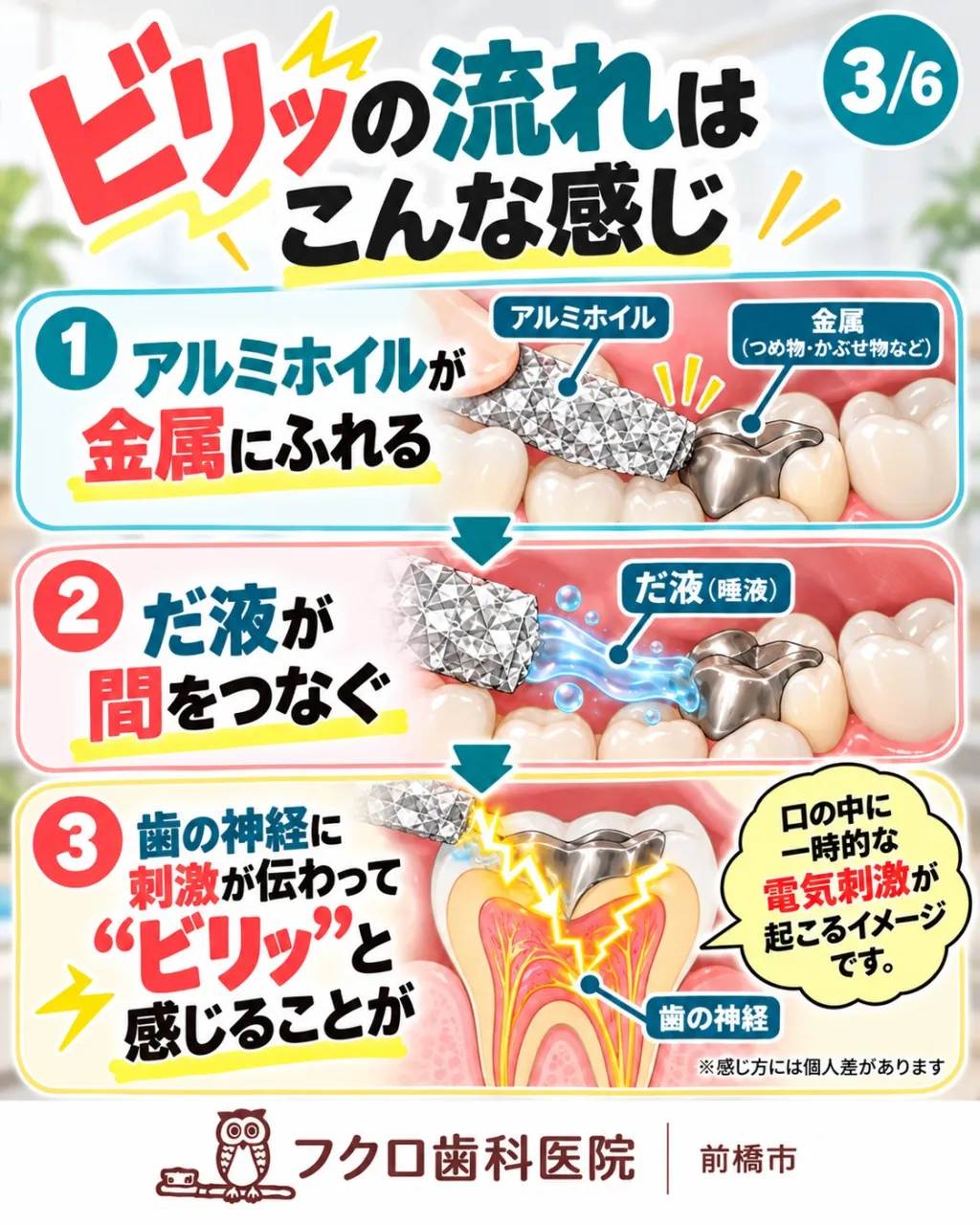 「うひゃぁ!? 歯がビリッとした!⚡️」