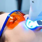 ホワイトニング